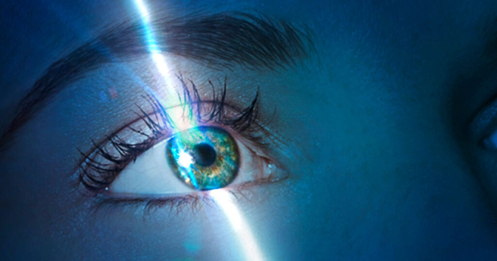 Expert tips from LASIK experts