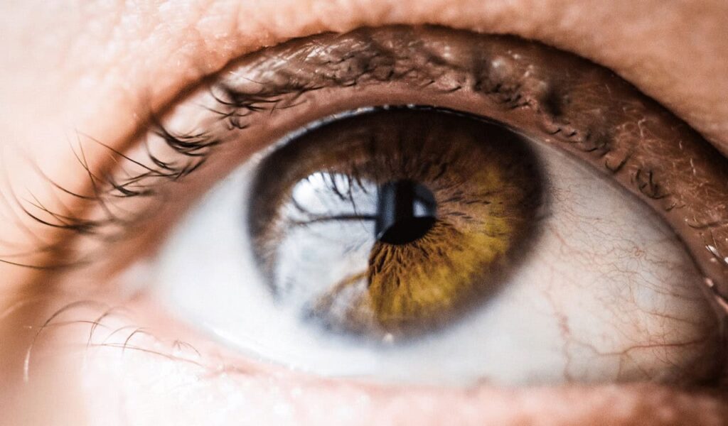 laser eye surgery
