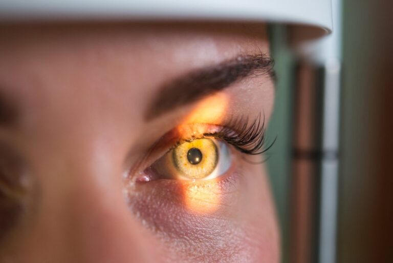laser eye surgery